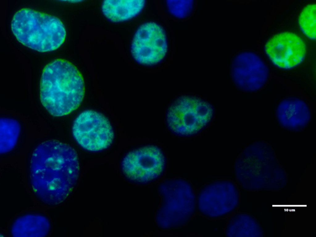 Fluorescence imaging of replicating HeLa cells detected with EdU