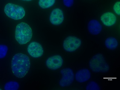 EdU Labelling with 6-Carboxyfluorescein Azide